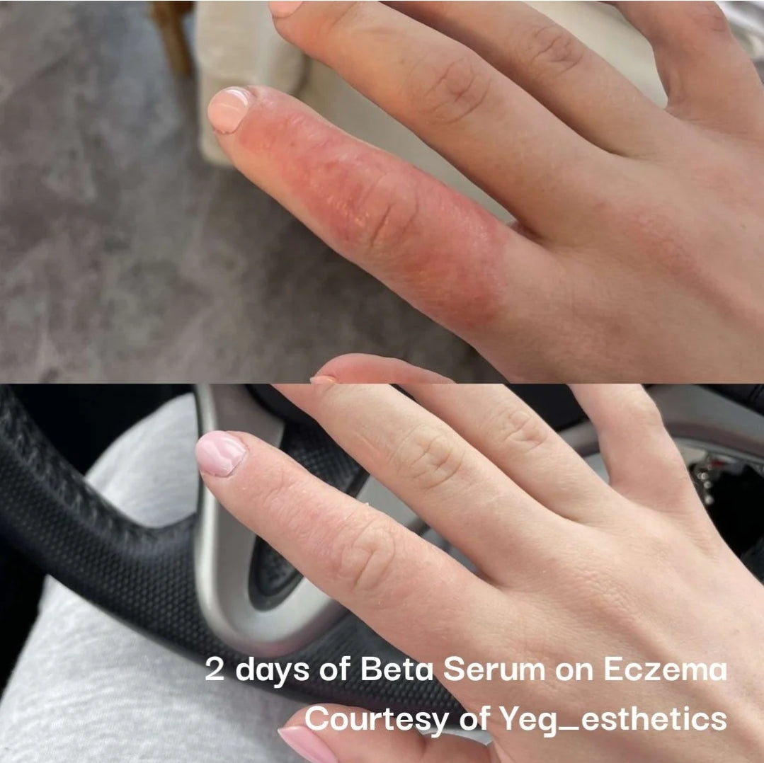 Beta-Glucan Serum