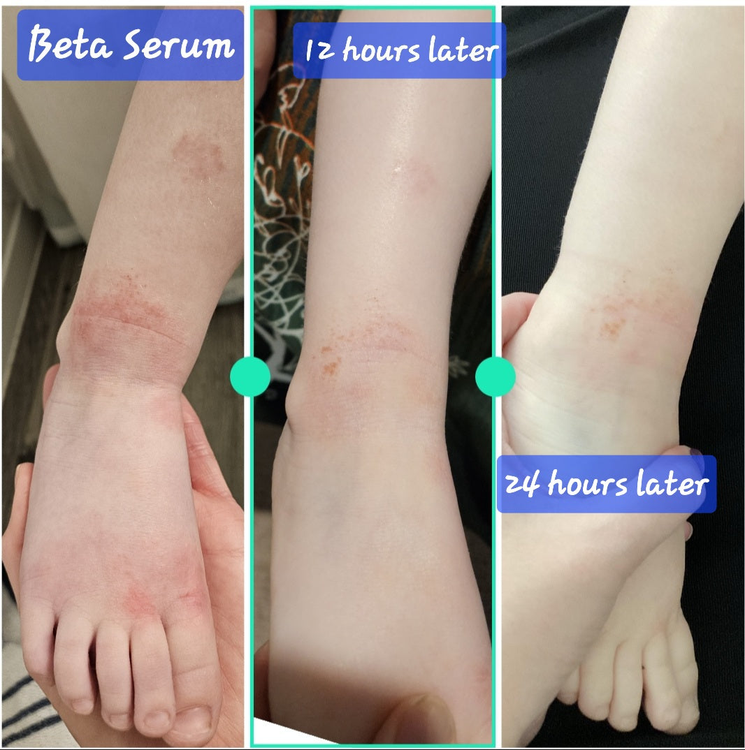Beta-Glucan Serum